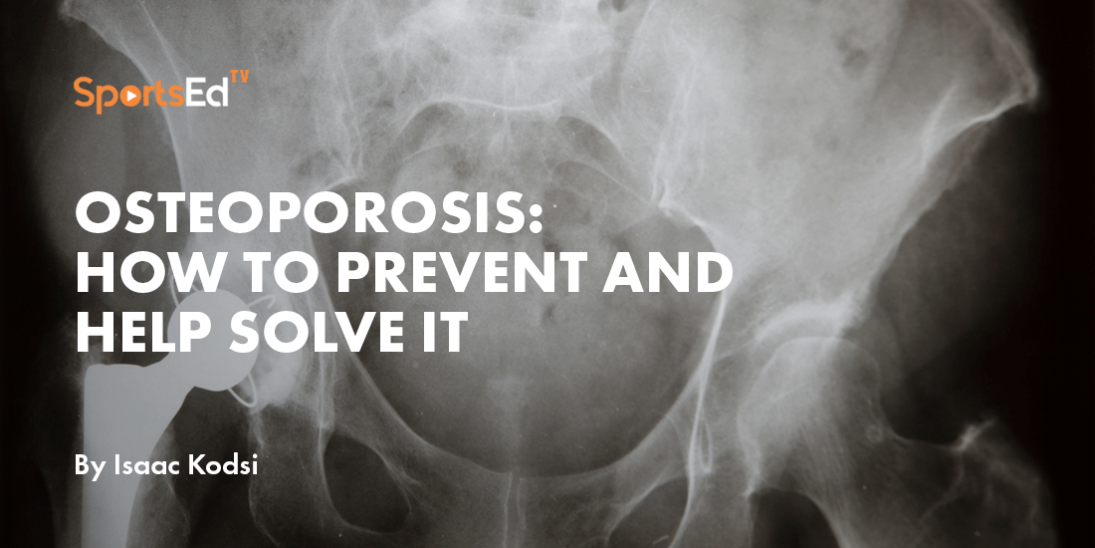 Osteoporosis: The Silent Disease